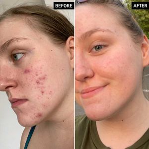 Glycolic Acid Toner The INKEY List Reduce pore