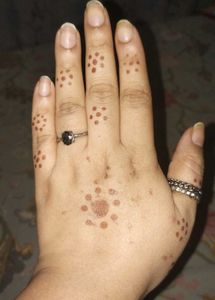 Antique Look Rings From Forever 21