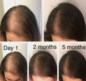 AYURVEDIC SHAMPOO 🚿