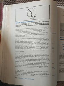 Basic Arrhythmias, Third Edition