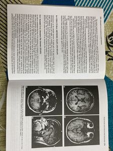 Fundamentals of Molecular Spectroscopy by Banwell