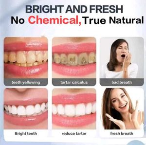 True SmileShine Tooth Cleaning &amp; Whitening Powder