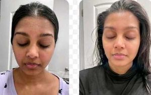 Skin Care Transformation Cream (Dermatologist)