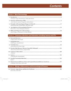 IADVL Concise Textbook of Dermatology