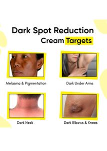 Masofta Dark Spot Reduction &amp; Removal Cream