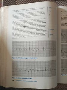 Basic Arrhythmias, Third Edition