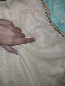 Frock