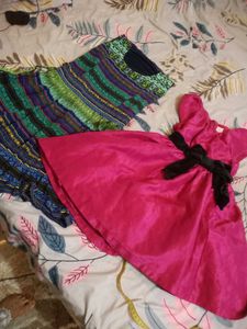 2 Frock