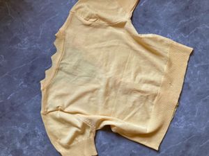 Yellow Scalloped Edge Cardigan