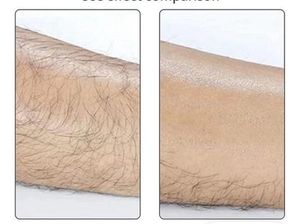 Crystal Hair Remover Epilator