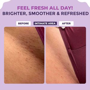 Sanfe Sensitive Areas Lightening Serum