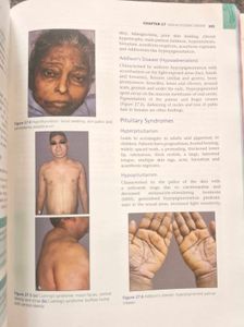 IADVL's Concise Textbook of Dermatology