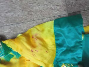 Kids Combo Dress,1to2years, Yellow Nail Oil Marks