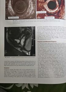 Sabiston Textbook of Surgery