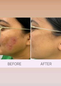 Oh My Skin Radiance Wash