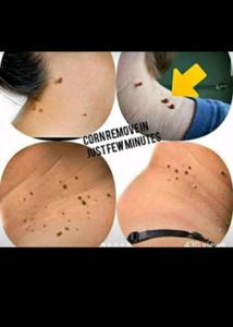 Hair And Skin All Problem Solution