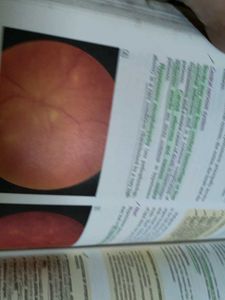 🛑Legendary Davidson Medicine Textbook