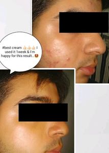 Fairness Cream 100% Results Money Back Gurantee If