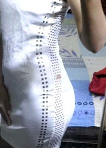 Tube Dress