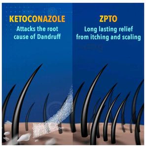 Scalpe Plus Ketoconazole 2% Anti Dandruff Shampoo