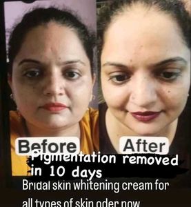 Bridal Whitening Night Cream