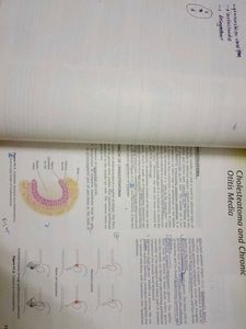 ENT-DHINGRA Medical Textbook