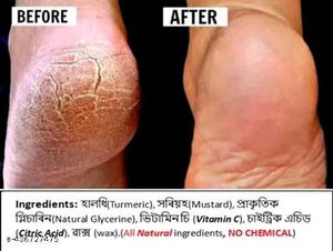 Foot Crack Healing Cream | See Reviews Before Buy