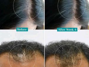 Pilgrim Hair growth Serum