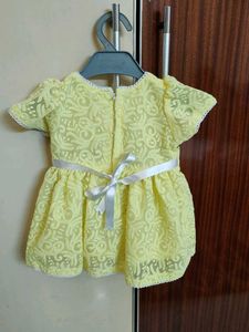 Yellow Frock For Babies