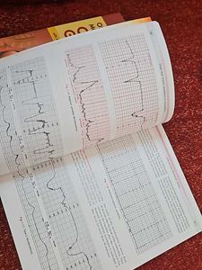 Obs And Gynae Model Papers