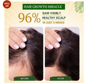 Rosemary Water for Hair Growth