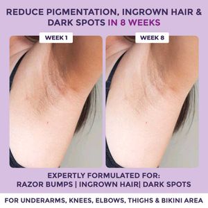 (Pack of 2) Sanfe Sensitive Areas Body Scrubs