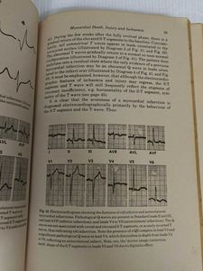 Electrocardiography Introduction