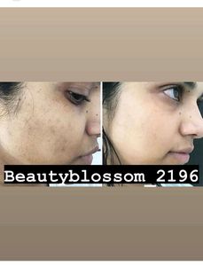 Beauty Blossom Whitening Cream