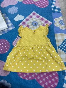 Baby frock