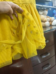 Yellow 🟡 Frock 💛