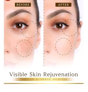 🆕🎊BRAND New SESA Kumkumadi Face Oil🎊🆕