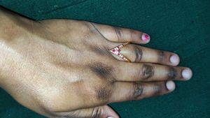 Vanki Ring  Totally New