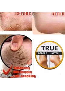 Crack Healing Balm