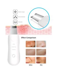 Black And White Head Removal Tool