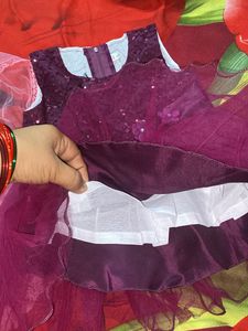 2 Frock Combo For Baby Girl