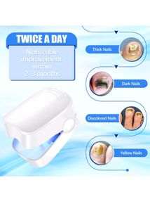 Sale 🎊 Nail Fungus Tratment For Toe,hand