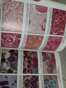 Textbook of Pathology