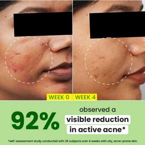 Dot &amp; Key Cica Salicylic Serum