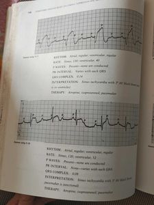 Dysrhythmia Interpretation Book