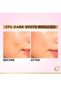 Loreal Serum+Day Cream Reduce Dark