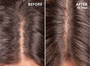 Regrow Rapid Hair Oil