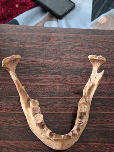 skull,sclap ,madable and vertebre