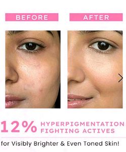 Hyphen Advanced De-Pigmentation Serum