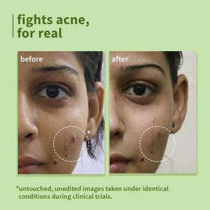 DOT &amp; KEY Cica + Salicylic Acid Face Wash